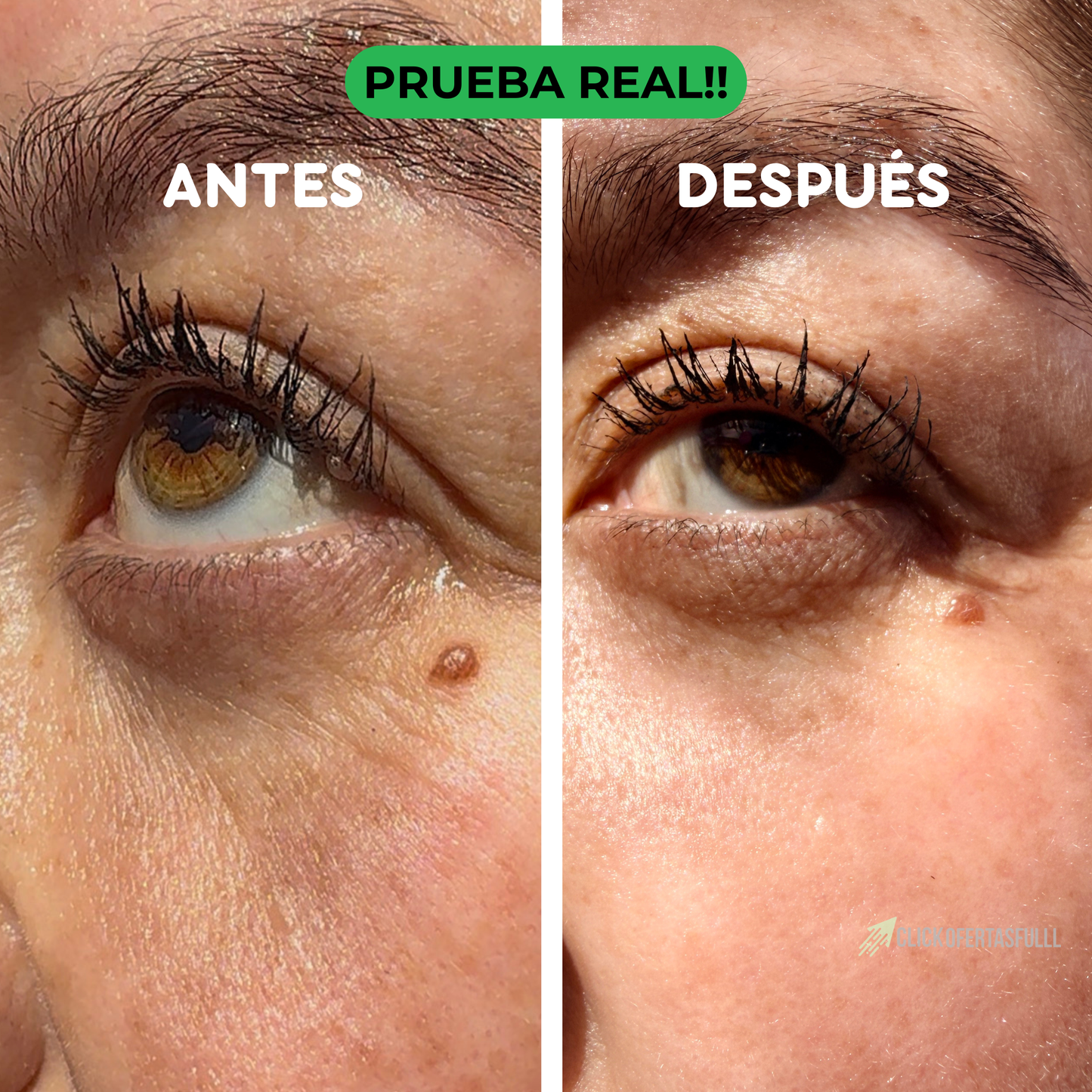 REGENYA (tm) – Rejuvenece contorno de ojos.